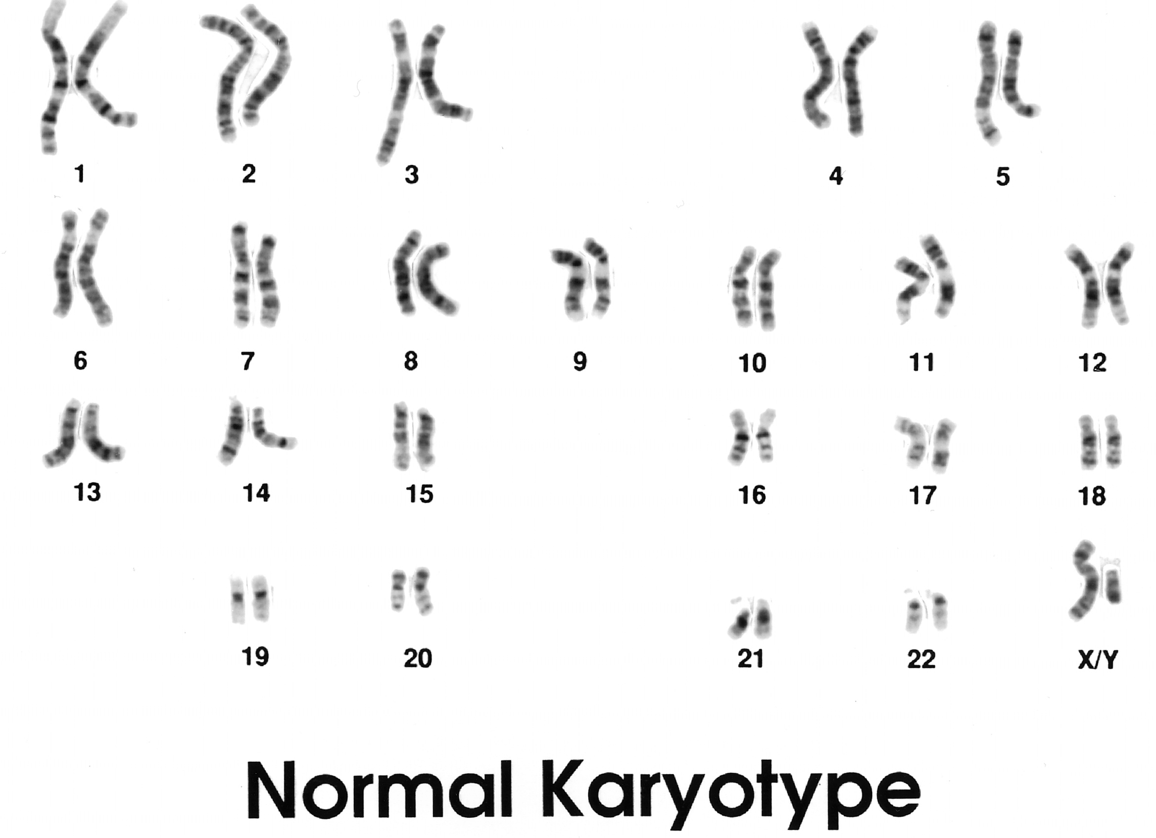 Хромосомы человека