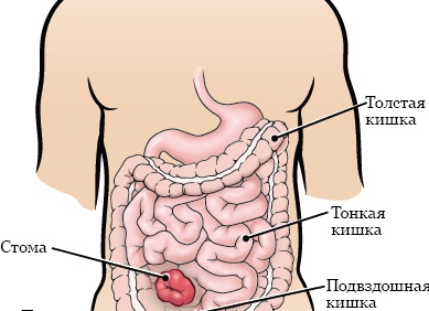 Эти организмы способны выдерживать температуру в 130 °C