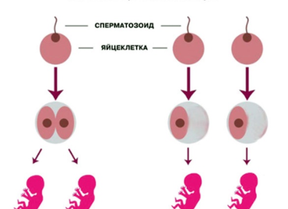 Почему близнецы похожи друг на друга